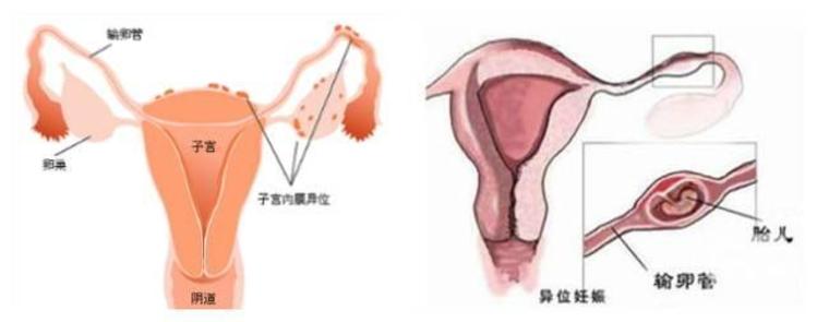 清宫生男生女表