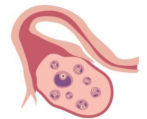 潮州美国泰国试管