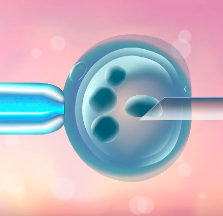 深圳试管婴儿医院